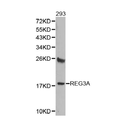 Western blot - REG3A antibody from Signalway Antibody (38363) - Antibodies.com