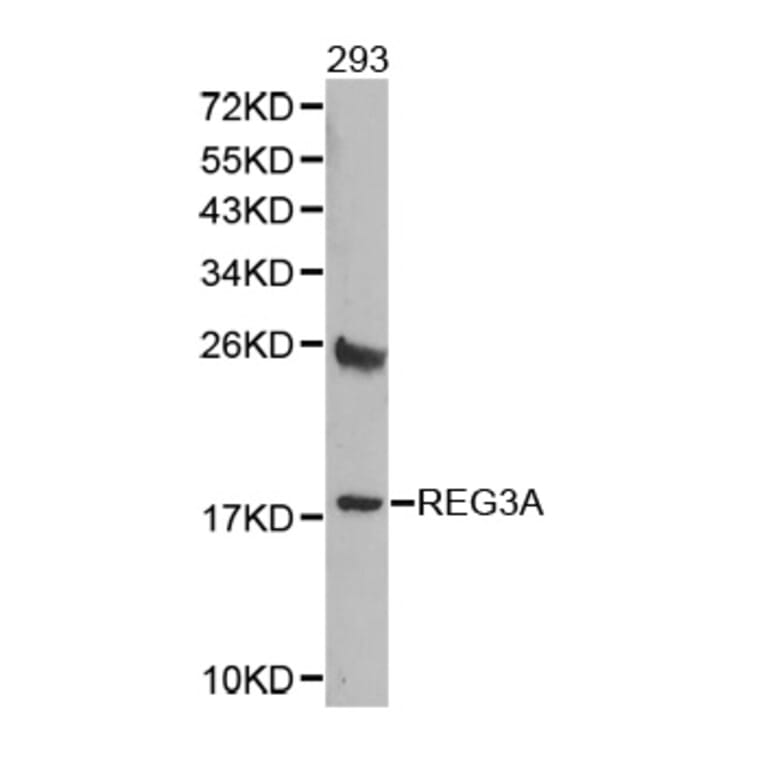 Western blot - REG3A antibody from Signalway Antibody (38363) - Antibodies.com