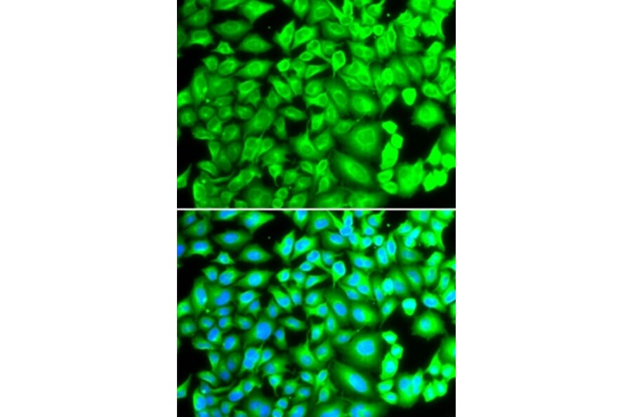 Immunofluorescence - REG3A antibody from Signalway Antibody (38363) - Antibodies.com