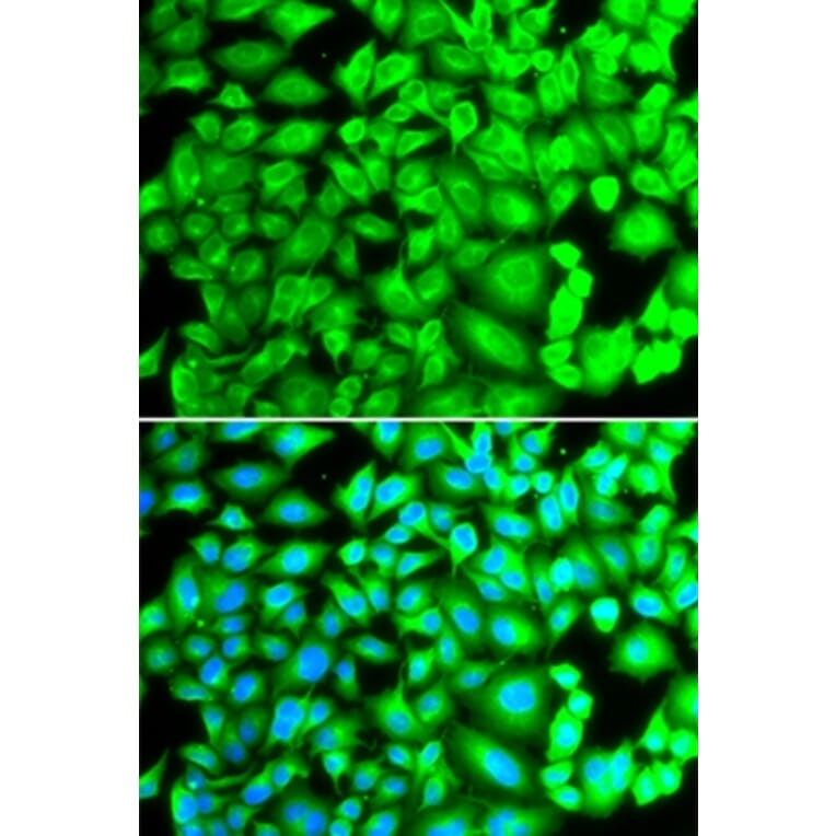 Immunofluorescence - REG3A antibody from Signalway Antibody (38363) - Antibodies.com