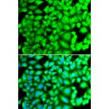 Immunofluorescence - REG3A antibody from Signalway Antibody (38363) - Antibodies.com