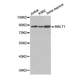 Western blot - MALT1 antibody from Signalway Antibody (38381) - Antibodies.com