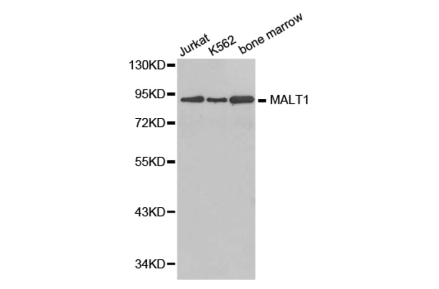 Western blot - MALT1 antibody from Signalway Antibody (38381) - Antibodies.com