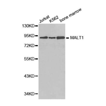 Western blot - MALT1 antibody from Signalway Antibody (38381) - Antibodies.com