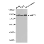 Western blot - MALT1 antibody from Signalway Antibody (38381) - Antibodies.com