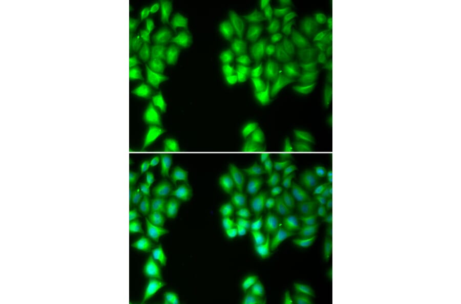 Immunofluorescence - MALT1 antibody from Signalway Antibody (38381) - Antibodies.com