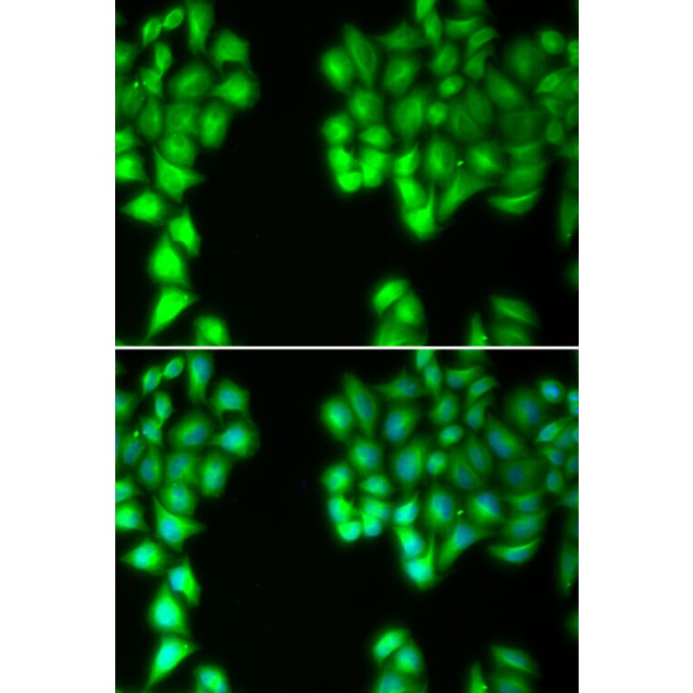 Immunofluorescence - MALT1 antibody from Signalway Antibody (38381) - Antibodies.com