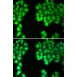 Immunofluorescence - MALT1 antibody from Signalway Antibody (38381) - Antibodies.com
