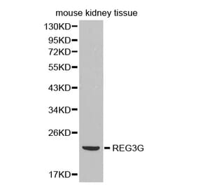 Western blot - REG3G antibody from Signalway Antibody (38382) - Antibodies.com