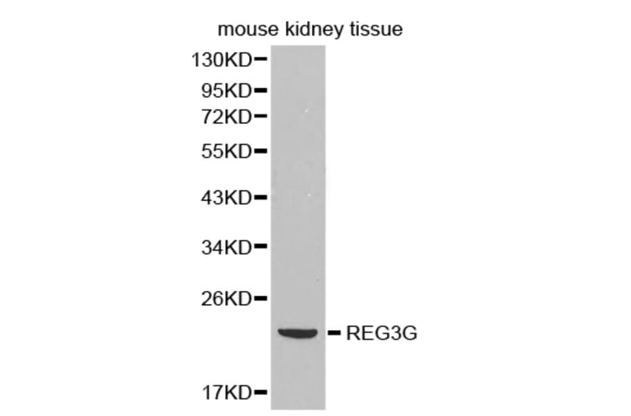 Western blot - REG3G antibody from Signalway Antibody (38382) - Antibodies.com