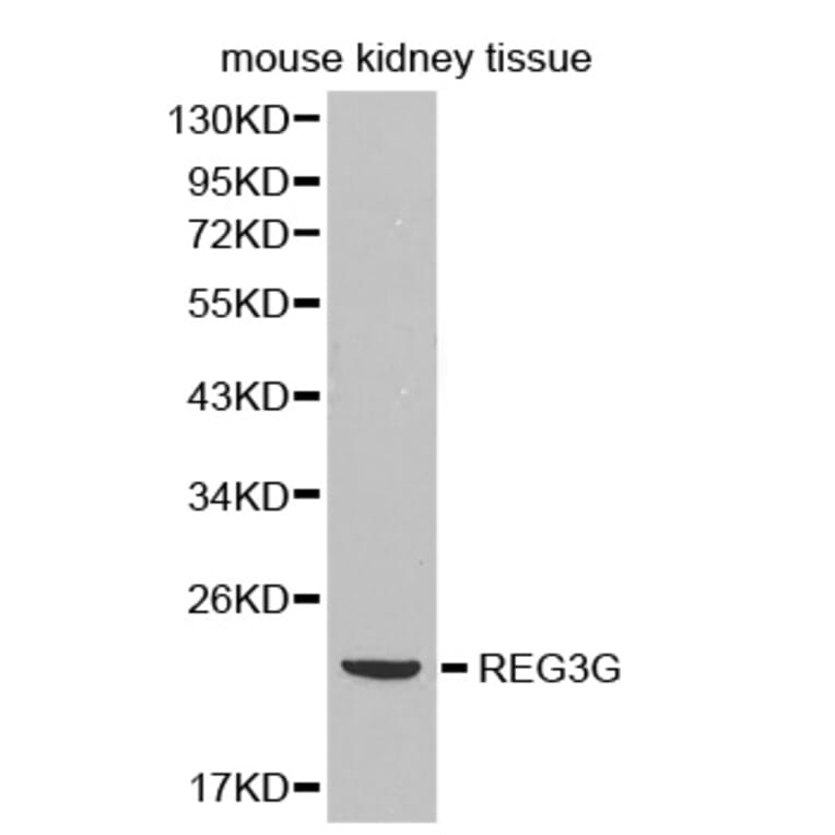 Western blot - REG3G antibody from Signalway Antibody (38382) - Antibodies.com