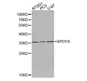 Western blot - SPDYA antibody from Signalway Antibody (38385) - Antibodies.com