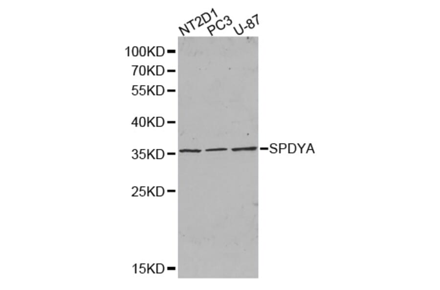 Western blot - SPDYA antibody from Signalway Antibody (38385) - Antibodies.com