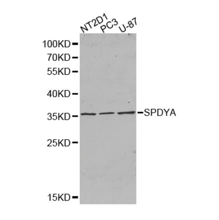 Western blot - SPDYA antibody from Signalway Antibody (38385) - Antibodies.com