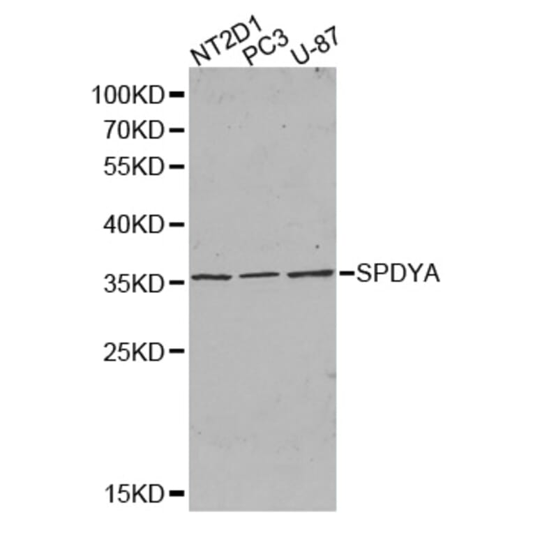 Western blot - SPDYA antibody from Signalway Antibody (38385) - Antibodies.com
