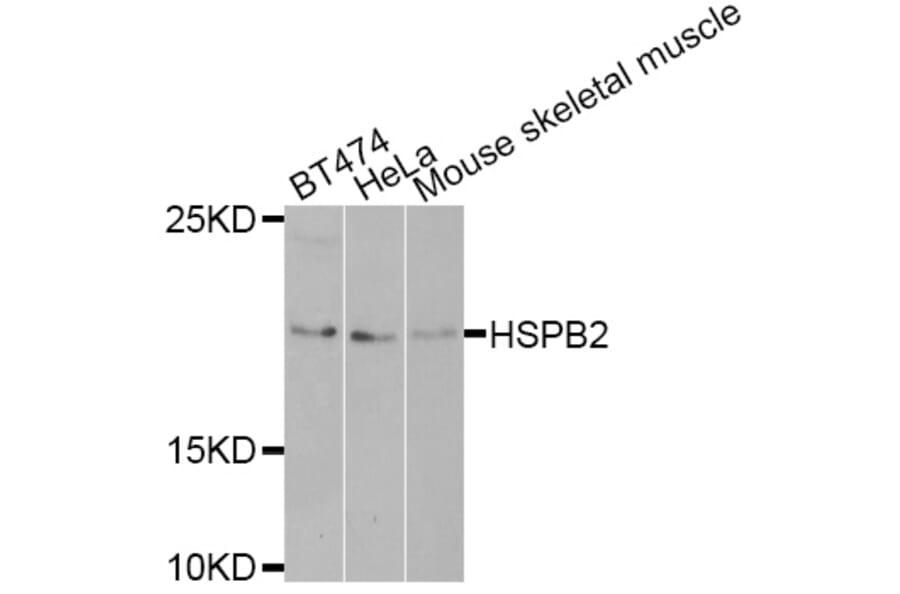 Western blot - HSPB2 antibody from Signalway Antibody (38402) - Antibodies.com