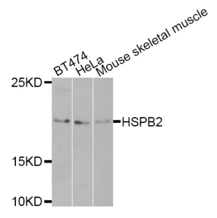 Western blot - HSPB2 antibody from Signalway Antibody (38402) - Antibodies.com