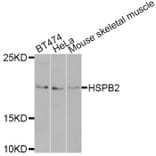 Western blot - HSPB2 antibody from Signalway Antibody (38402) - Antibodies.com