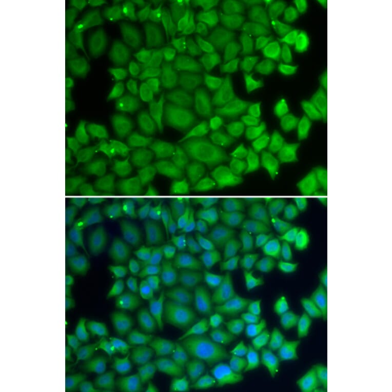 Immunofluorescence - HSPB2 antibody from Signalway Antibody (38402) - Antibodies.com