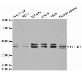 Western blot - EEF1D antibody from Signalway Antibody (38412) - Antibodies.com