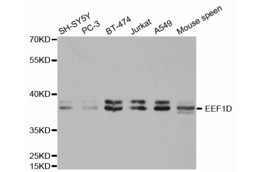 Western blot - EEF1D antibody from Signalway Antibody (38412) - Antibodies.com