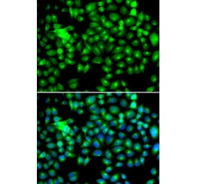 Immunofluorescence - HSPB8 antibody from Signalway Antibody (38413) - Antibodies.com