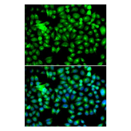 Immunofluorescence - HSPB8 antibody from Signalway Antibody (38413) - Antibodies.com