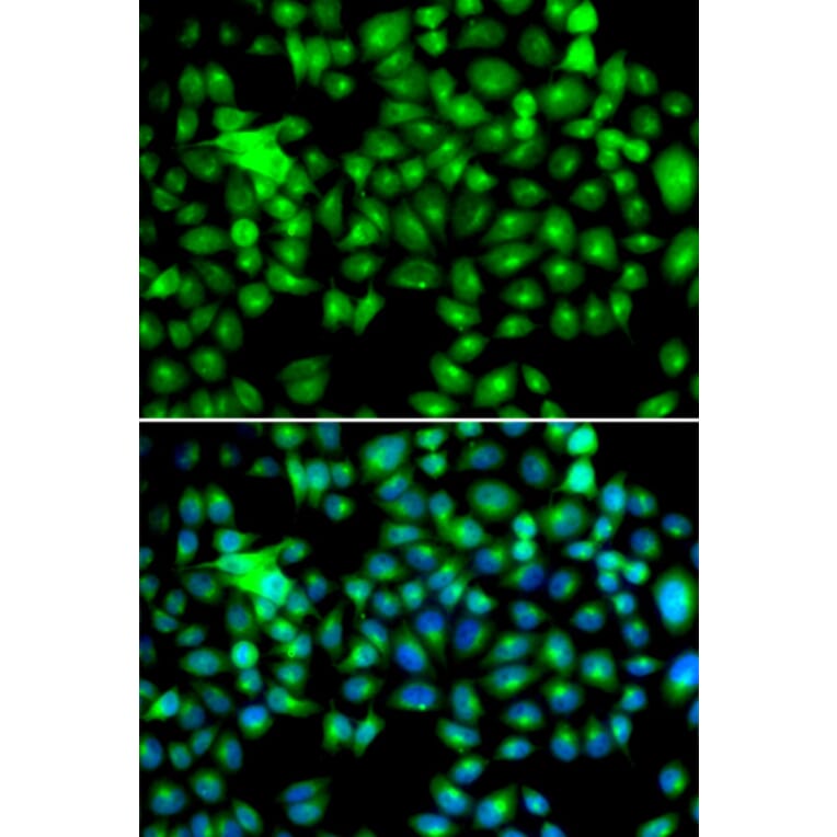 Immunofluorescence - HSPB8 antibody from Signalway Antibody (38413) - Antibodies.com