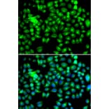 Immunofluorescence - HSPB8 antibody from Signalway Antibody (38413) - Antibodies.com