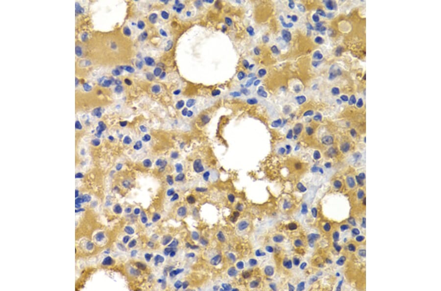 Immunohistochemistry - HSPB8 antibody from Signalway Antibody (38413) - Antibodies.com