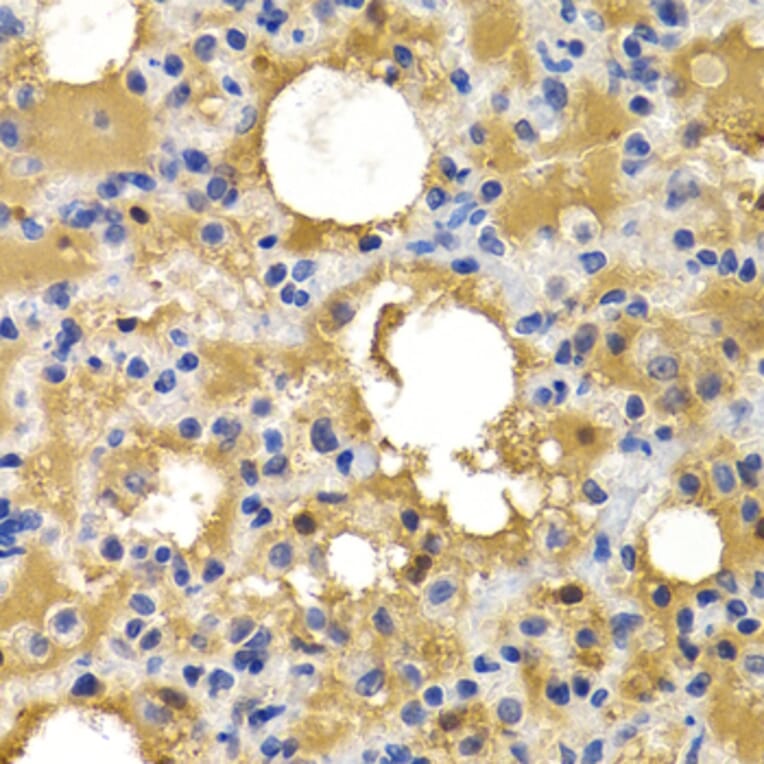 Immunohistochemistry - HSPB8 antibody from Signalway Antibody (38413) - Antibodies.com