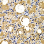 Immunohistochemistry - HSPB8 antibody from Signalway Antibody (38413) - Antibodies.com