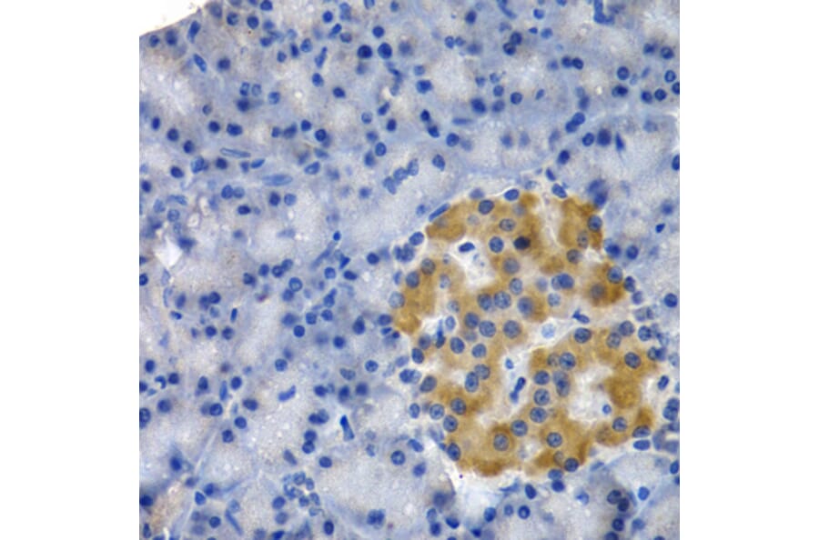 Immunohistochemistry - HSPB8 antibody from Signalway Antibody (38413) - Antibodies.com