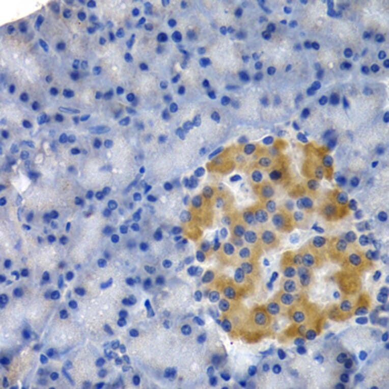 Immunohistochemistry - HSPB8 antibody from Signalway Antibody (38413) - Antibodies.com