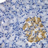 Immunohistochemistry - HSPB8 antibody from Signalway Antibody (38413) - Antibodies.com