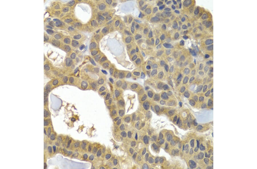 Immunohistochemistry - HSPB8 antibody from Signalway Antibody (38413) - Antibodies.com