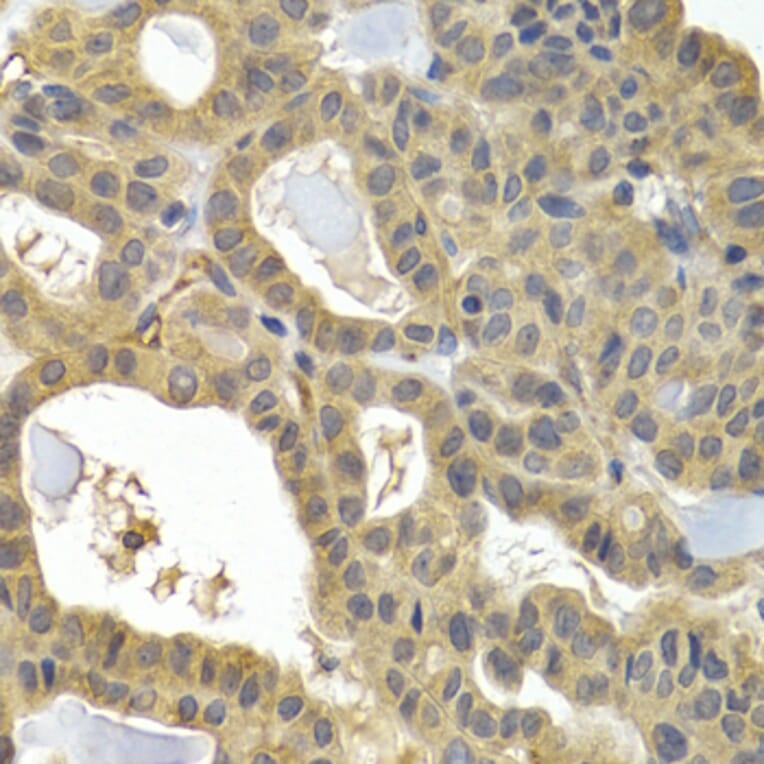 Immunohistochemistry - HSPB8 antibody from Signalway Antibody (38413) - Antibodies.com
