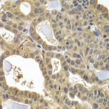 Immunohistochemistry - HSPB8 antibody from Signalway Antibody (38413) - Antibodies.com