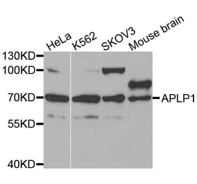 Western blot - APLP1 antibody from Signalway Antibody (38431) - Antibodies.com