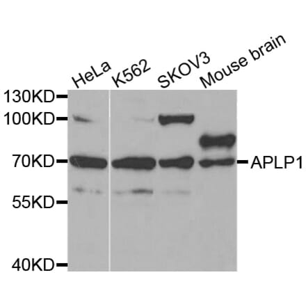Western blot - APLP1 antibody from Signalway Antibody (38431) - Antibodies.com