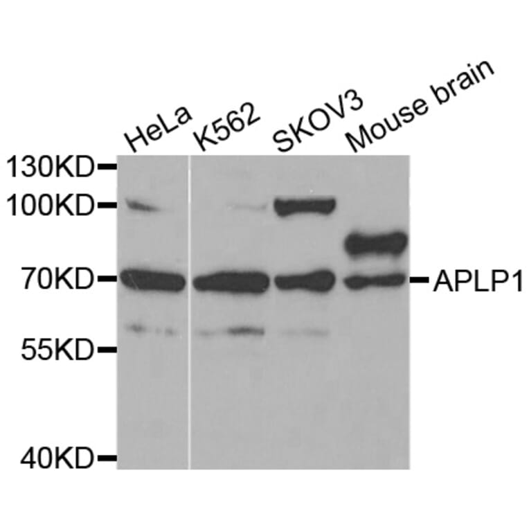 Western blot - APLP1 antibody from Signalway Antibody (38431) - Antibodies.com