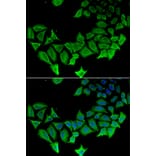Immunofluorescence - APLP1 antibody from Signalway Antibody (38431) - Antibodies.com