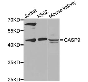 Western blot - CASP9 antibody from Signalway Antibody (38432) - Antibodies.com