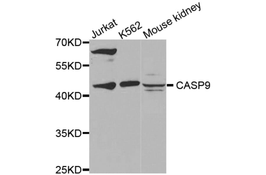Western blot - CASP9 antibody from Signalway Antibody (38432) - Antibodies.com