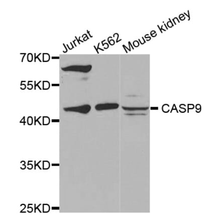 Western blot - CASP9 antibody from Signalway Antibody (38432) - Antibodies.com
