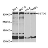Western blot - SETD2 antibody from Signalway Antibody (38633) - Antibodies.com
