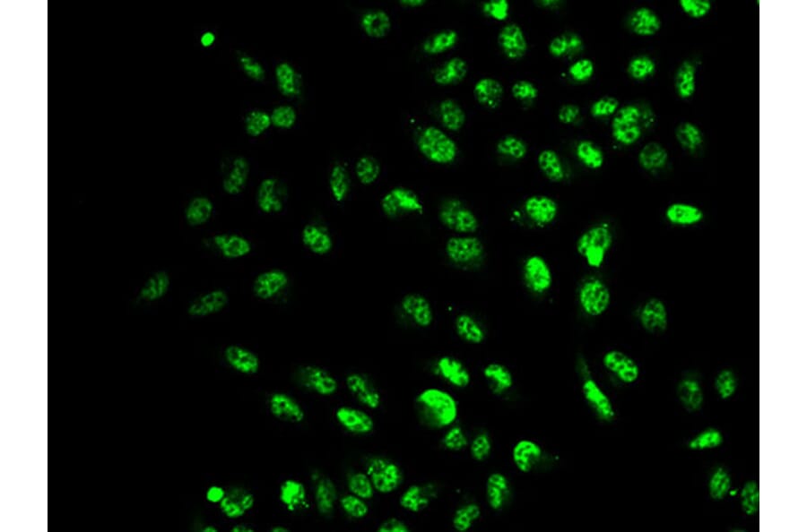 Immunofluorescence - SETD2 antibody from Signalway Antibody (38633) - Antibodies.com