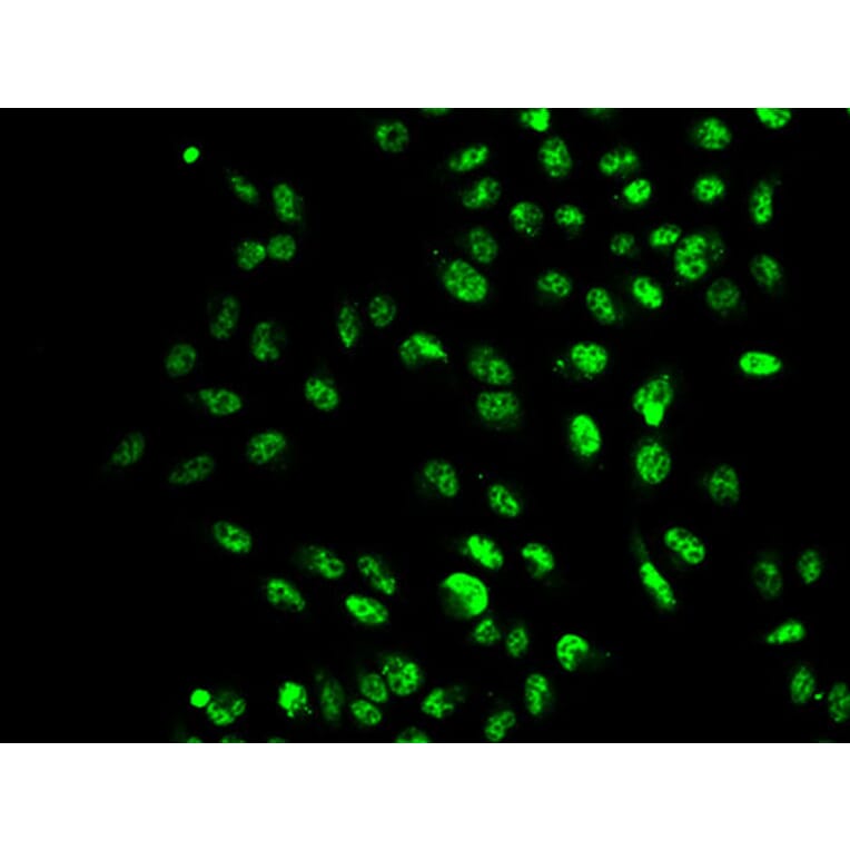 Immunofluorescence - SETD2 antibody from Signalway Antibody (38633) - Antibodies.com