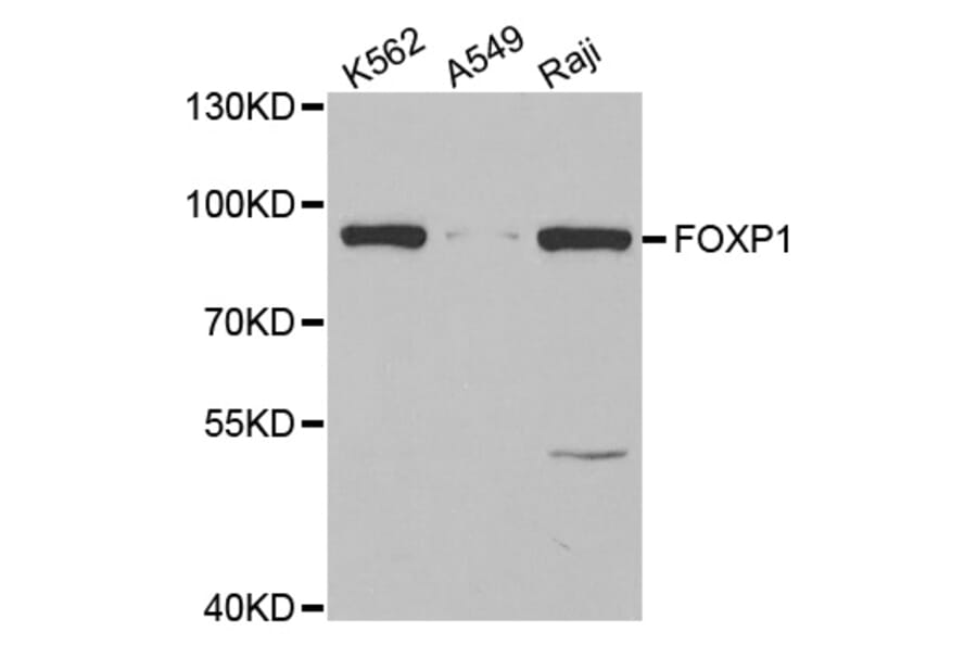 Western blot - FOXP1 antibody from Signalway Antibody (38637) - Antibodies.com