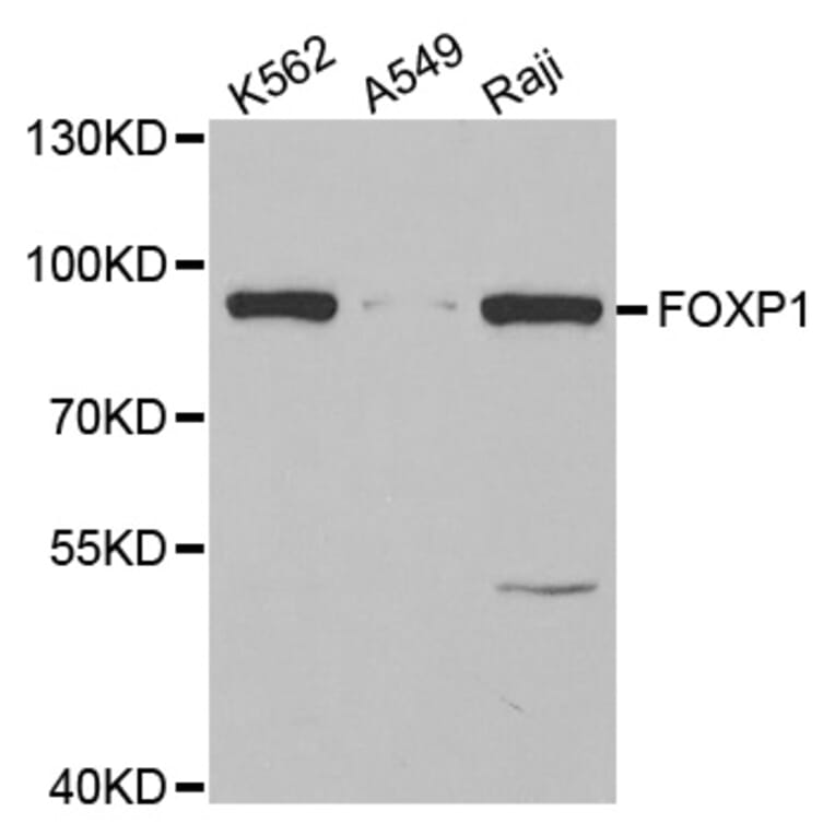 Western blot - FOXP1 antibody from Signalway Antibody (38637) - Antibodies.com